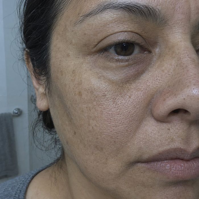 Piel gris y apagada a los 50
