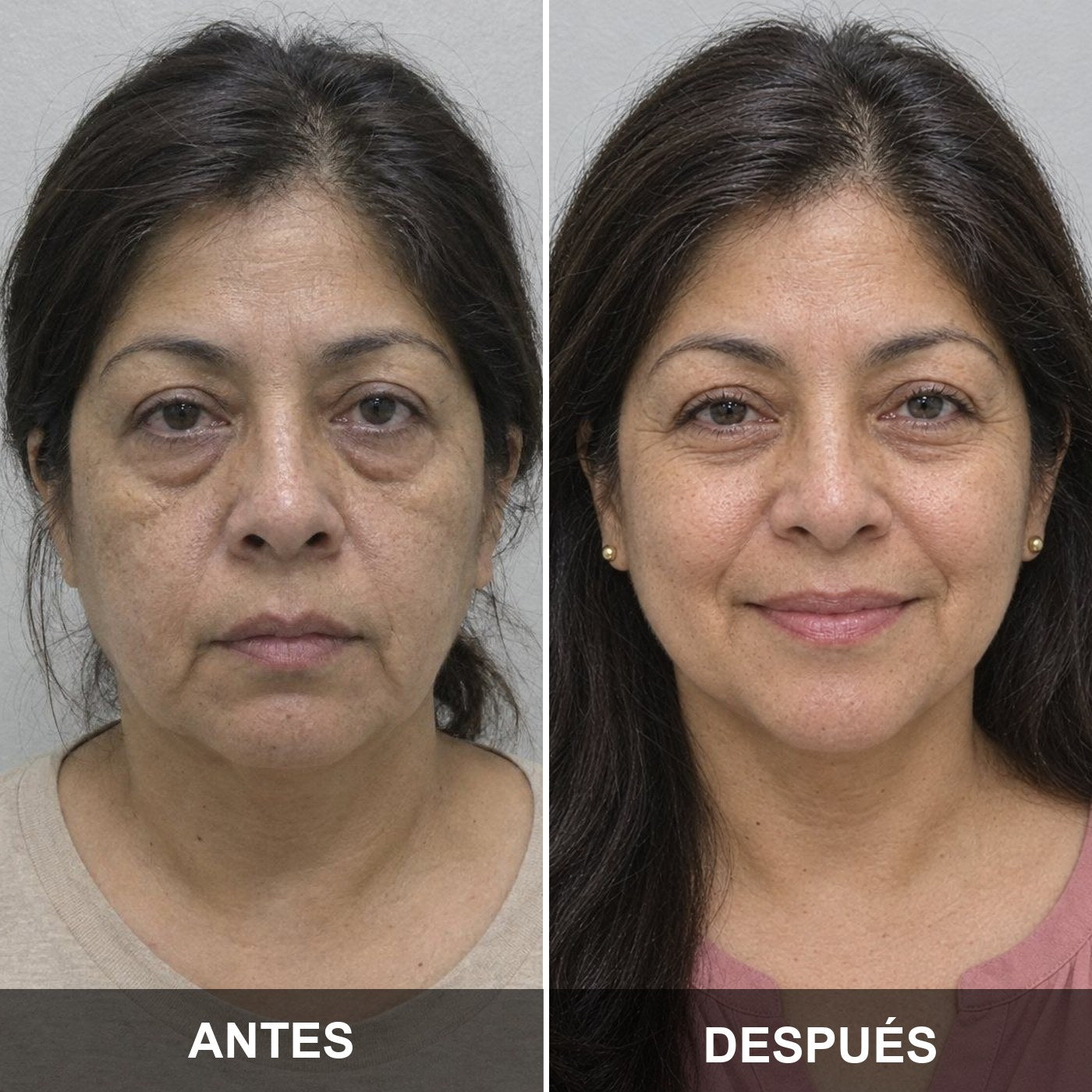 Antes y después